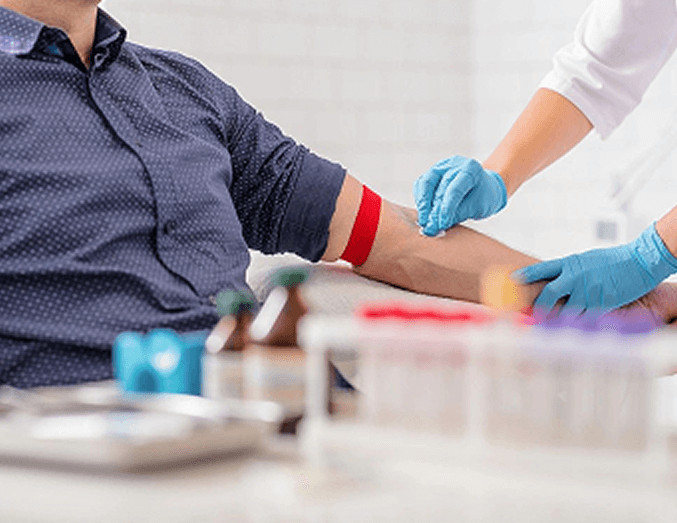 Blood testing services in Port st Lucie by Secure Labs