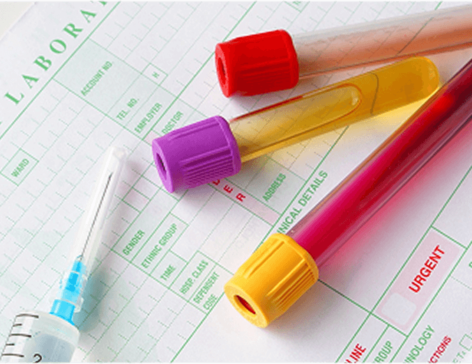 mobile phlebotomy in Vero Beach by Secure Labs